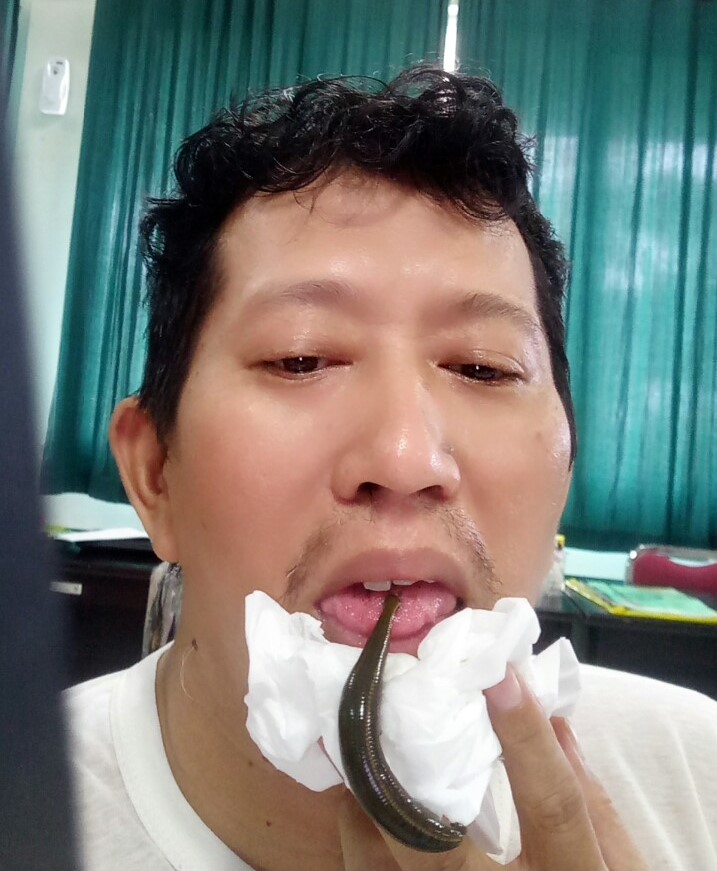 Terapi Lintah di titik ujung lidah untuk Penderita Penyakit Jantung. (foto: istimewa/palontaraq)