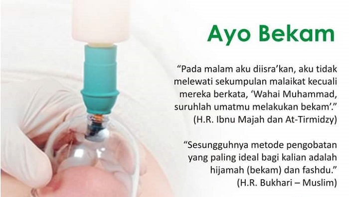 Ayo Bekam. (foto: ist/palontaraq)