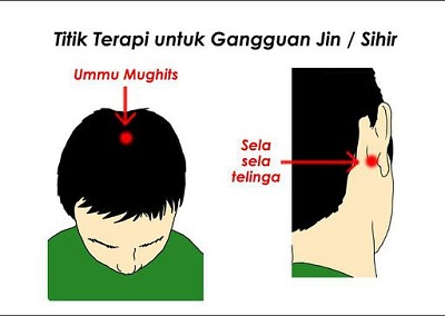 Titik terapi ruqyah. (foto: ist/palontaraq)